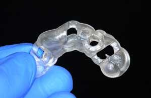 Dental Implant Guide