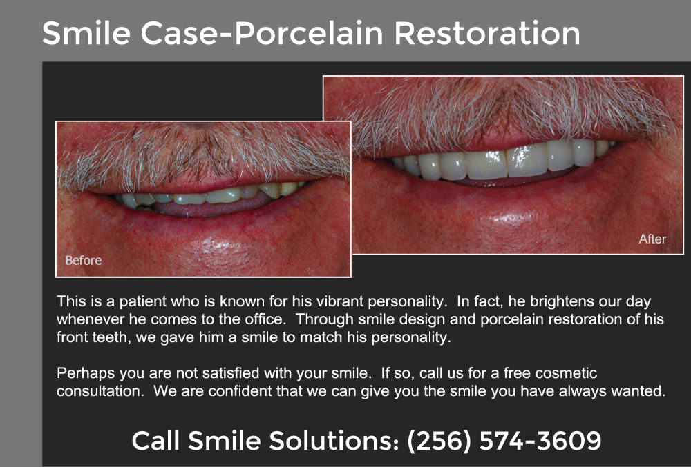 Porcelain Restoration Scottsboro, AL