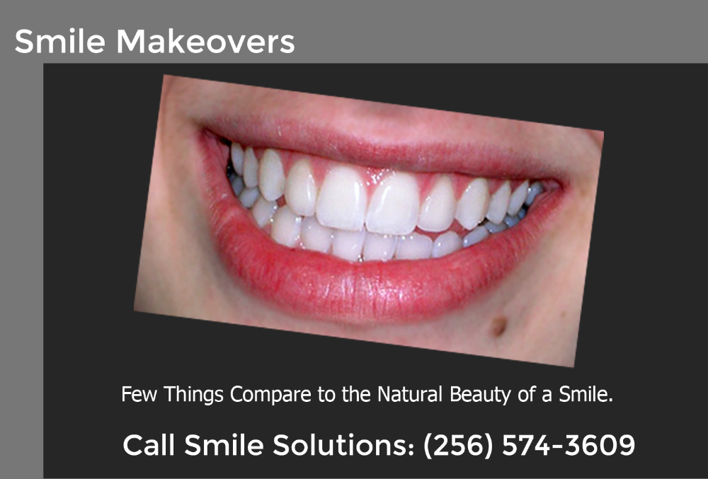 Smile Makeovers at Smile Solutions