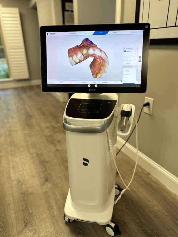 Smile Solutions Digital Impressions